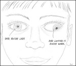 lazyeye